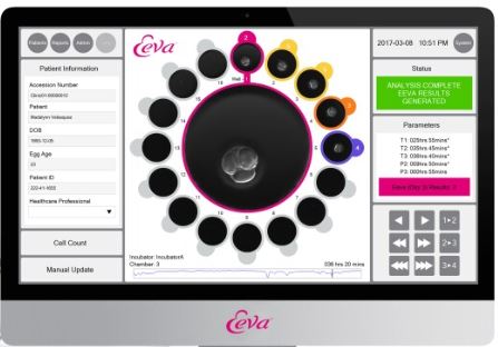 Illustration of Smart Embryo Selection Test