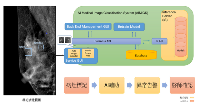 Breast Tumor AI Interpretation System Diagram