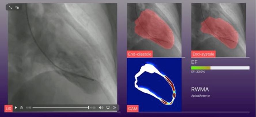 Solutions for heart failure and structural abnormalities will become The first step to productize open source intelligent manufacturing